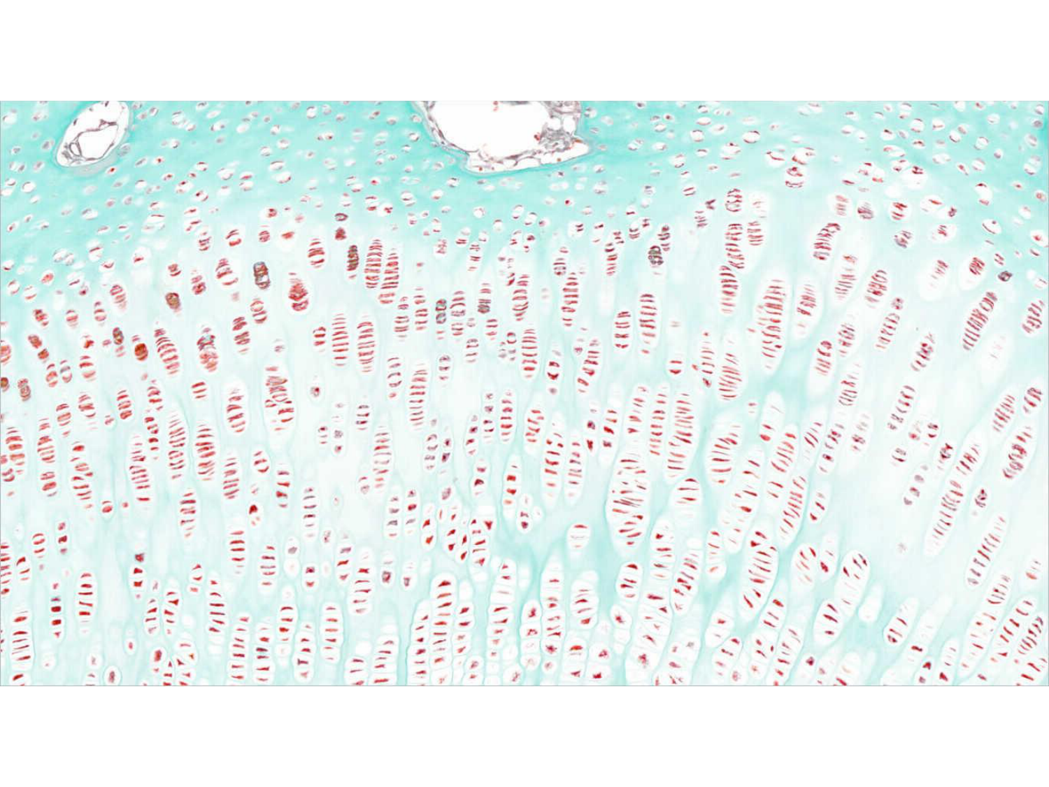 TP os et cartilage page 14