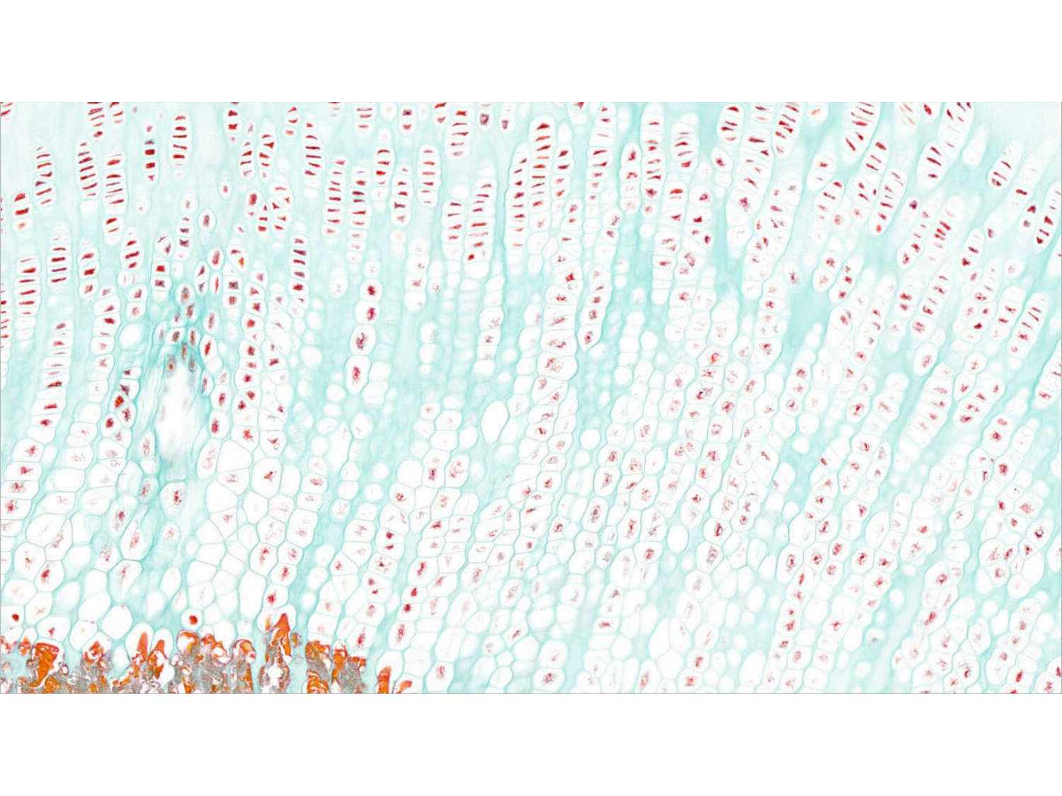 TP os et cartilage page 15