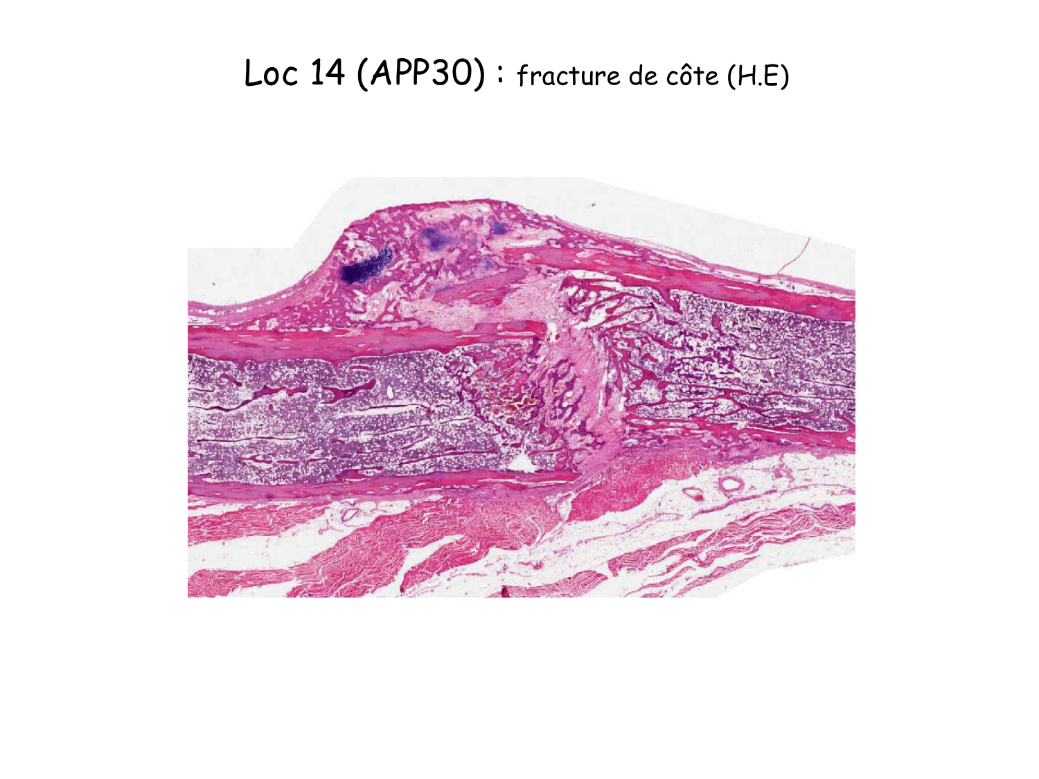 TP os et cartilage page 39
