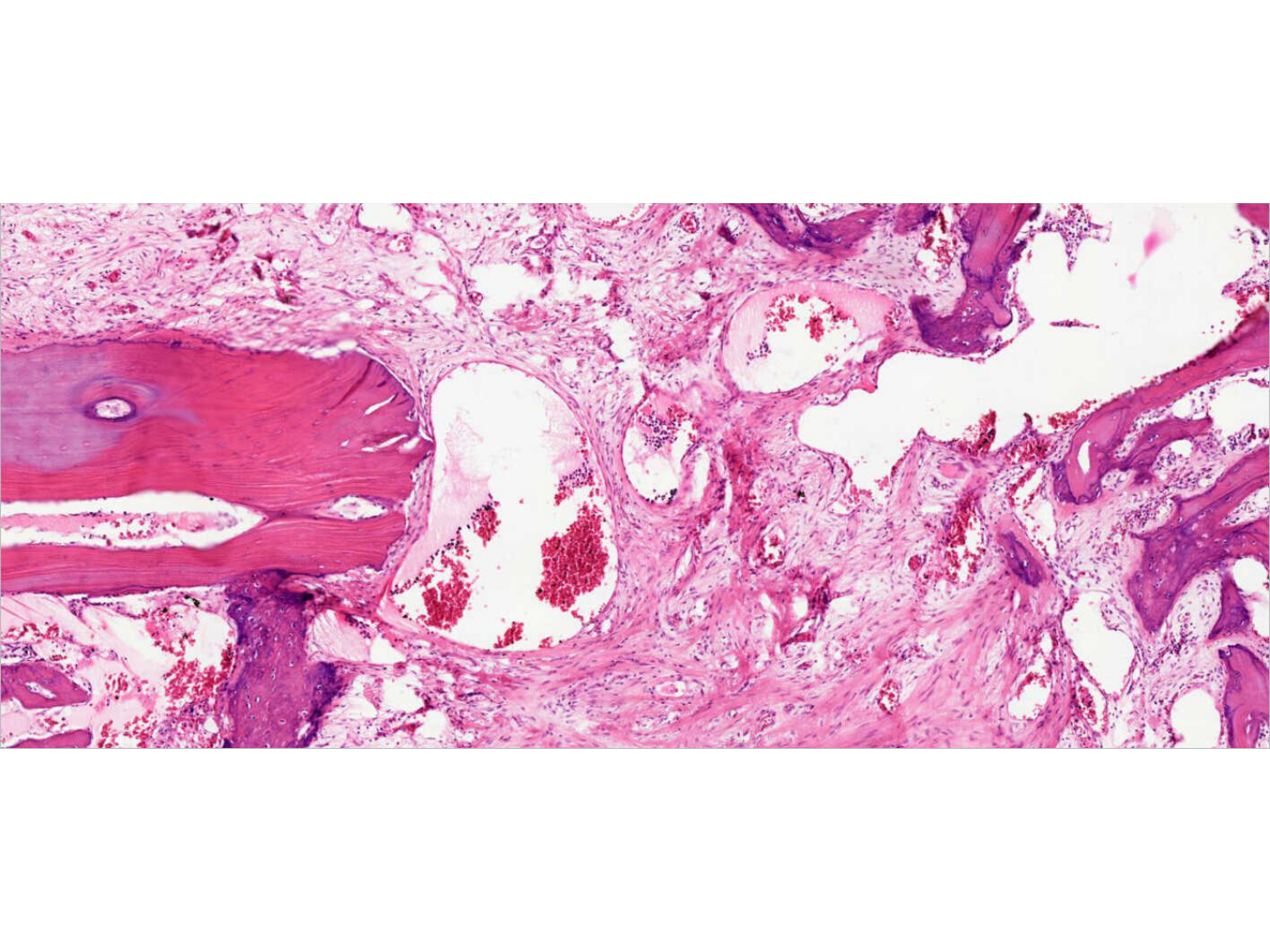 TP os et cartilage page 41