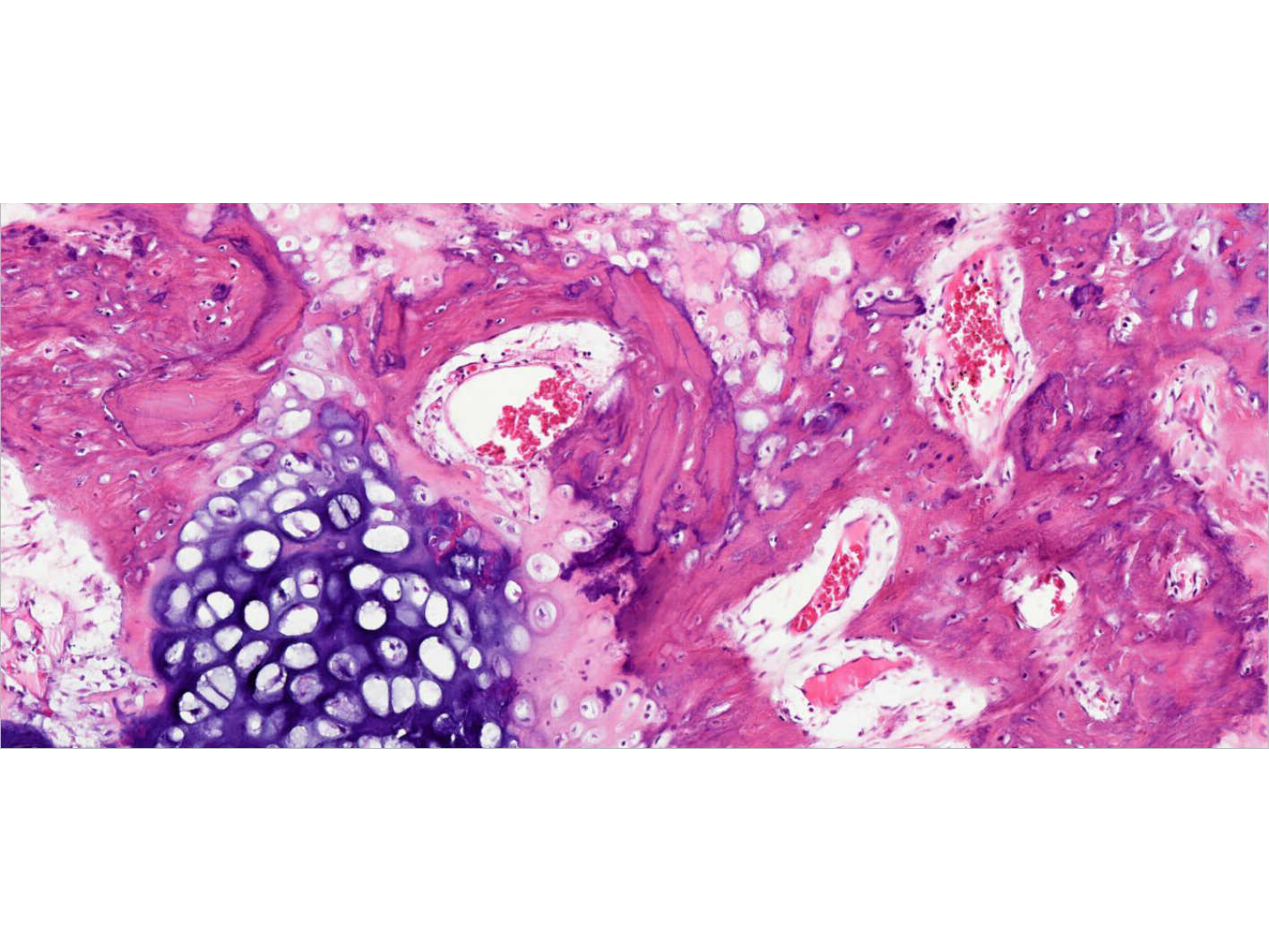 TP os et cartilage page 44