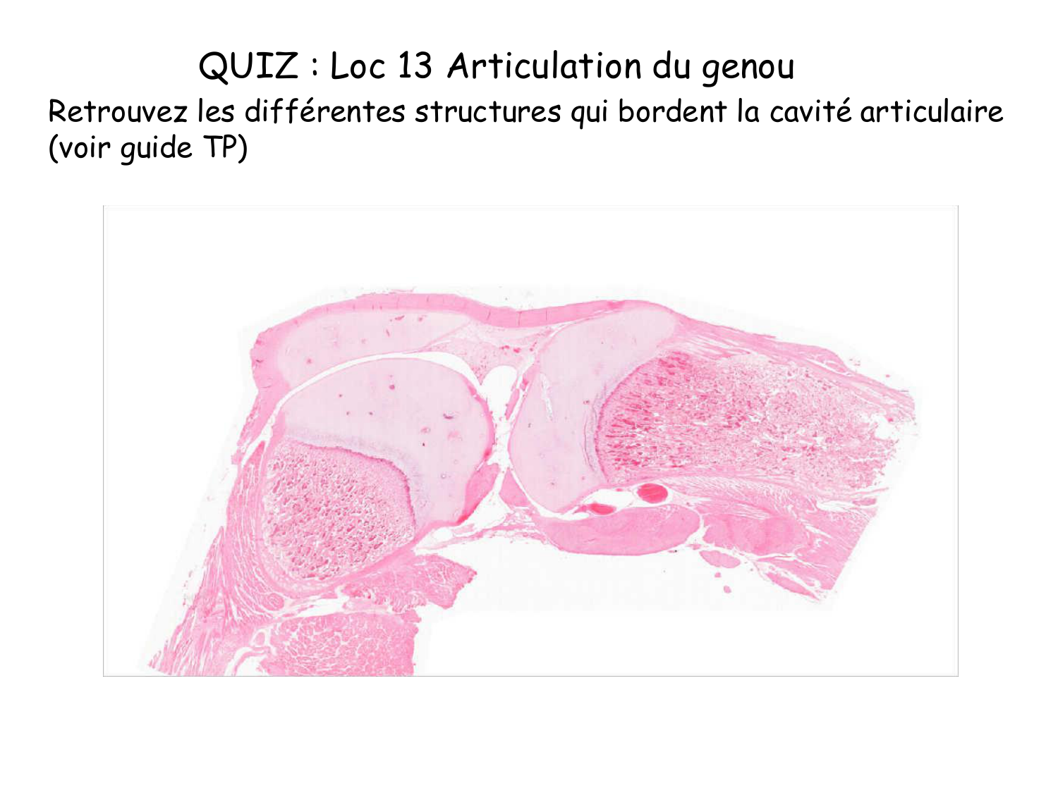 TP os et cartilage page 45