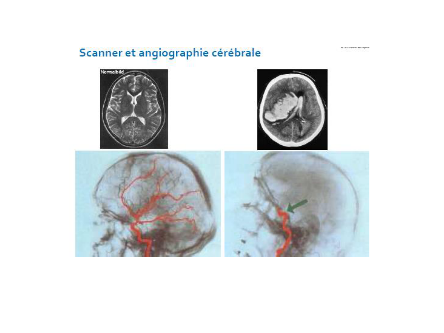 1ere 18.03 2026 Villard day 1 page 55