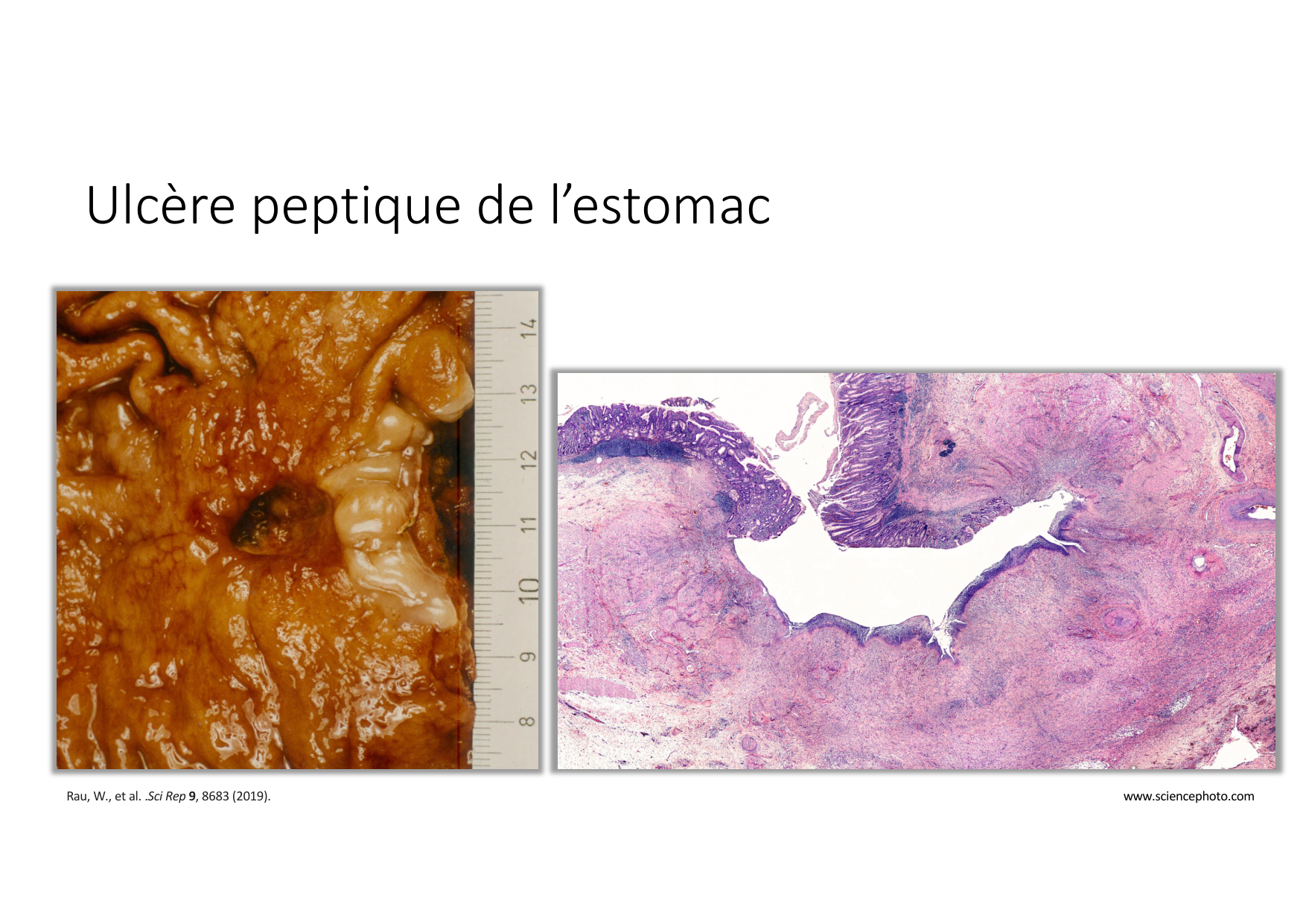 Résolution de linflammation 2026 Egervari page 26