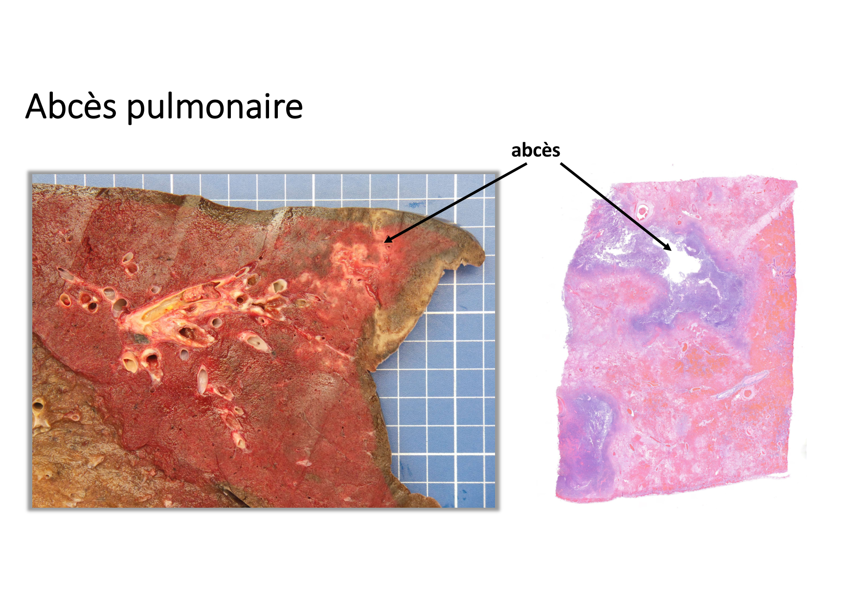 Résolution de linflammation 2026 Egervari page 28