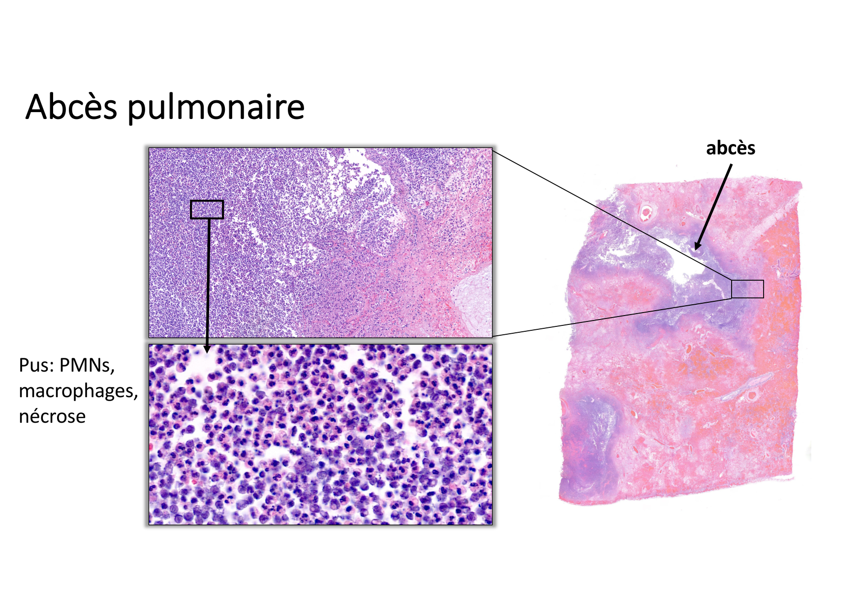 Résolution de linflammation 2026 Egervari page 29