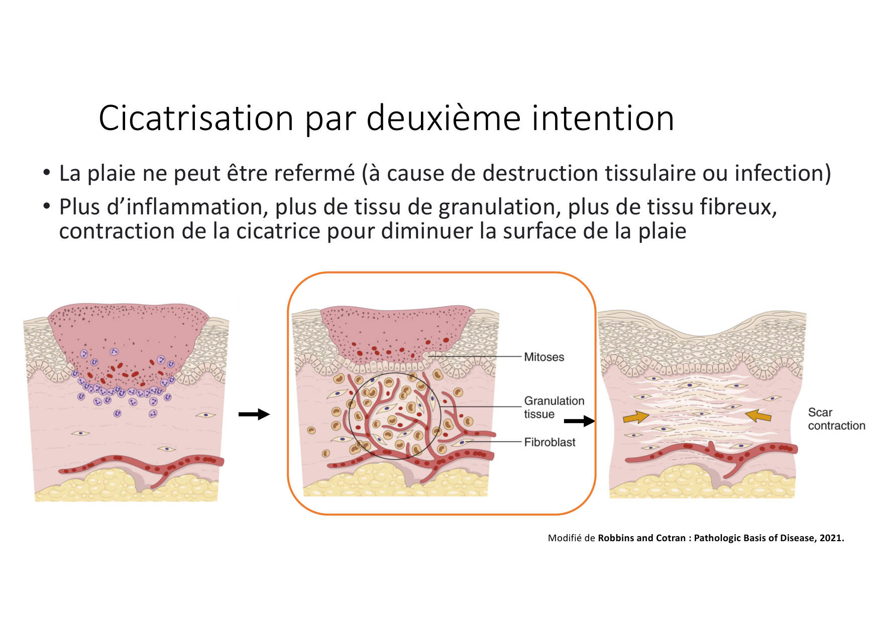 Résolution de linflammation 2026 Egervari page 30