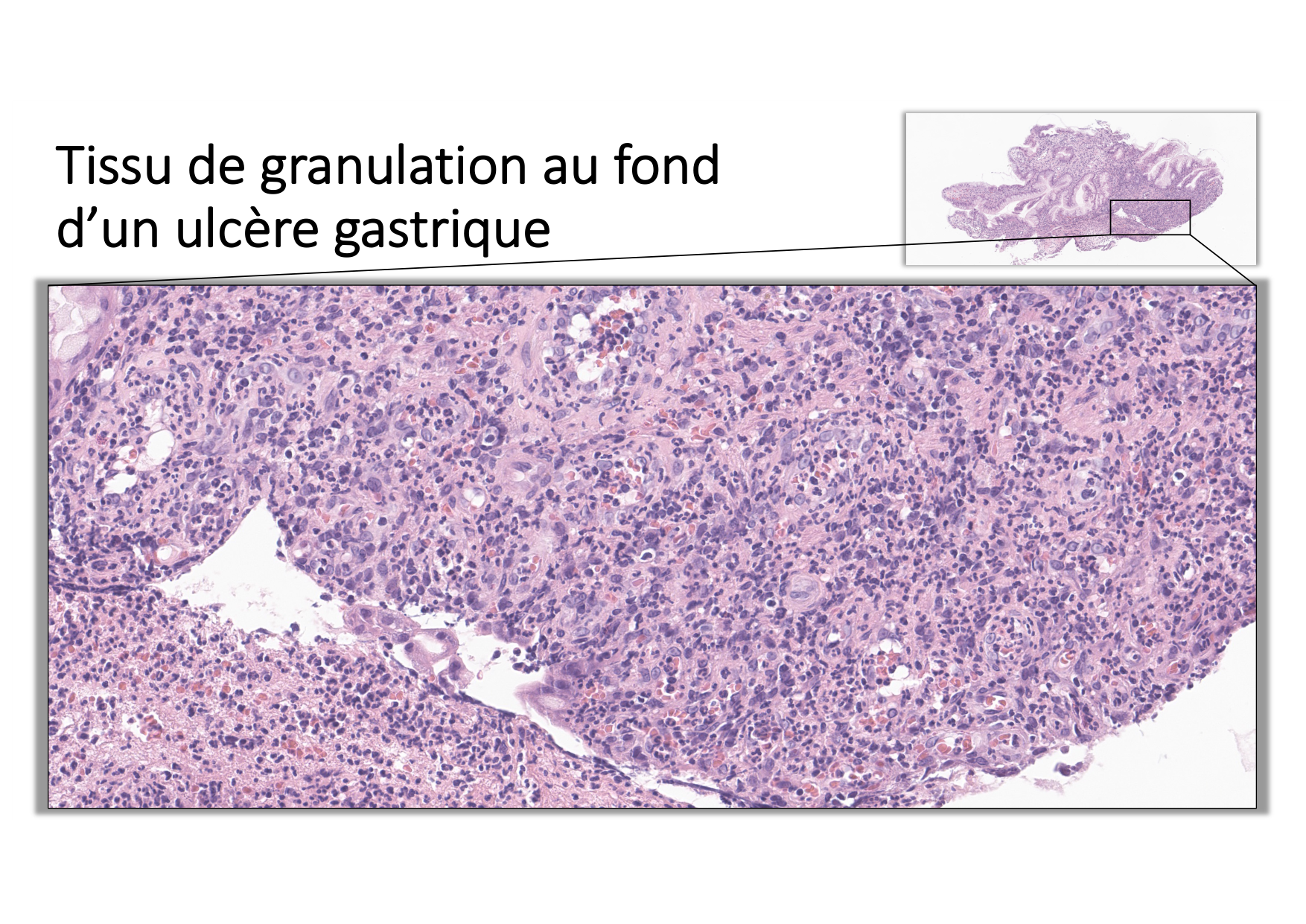 Résolution de linflammation 2026 Egervari page 32