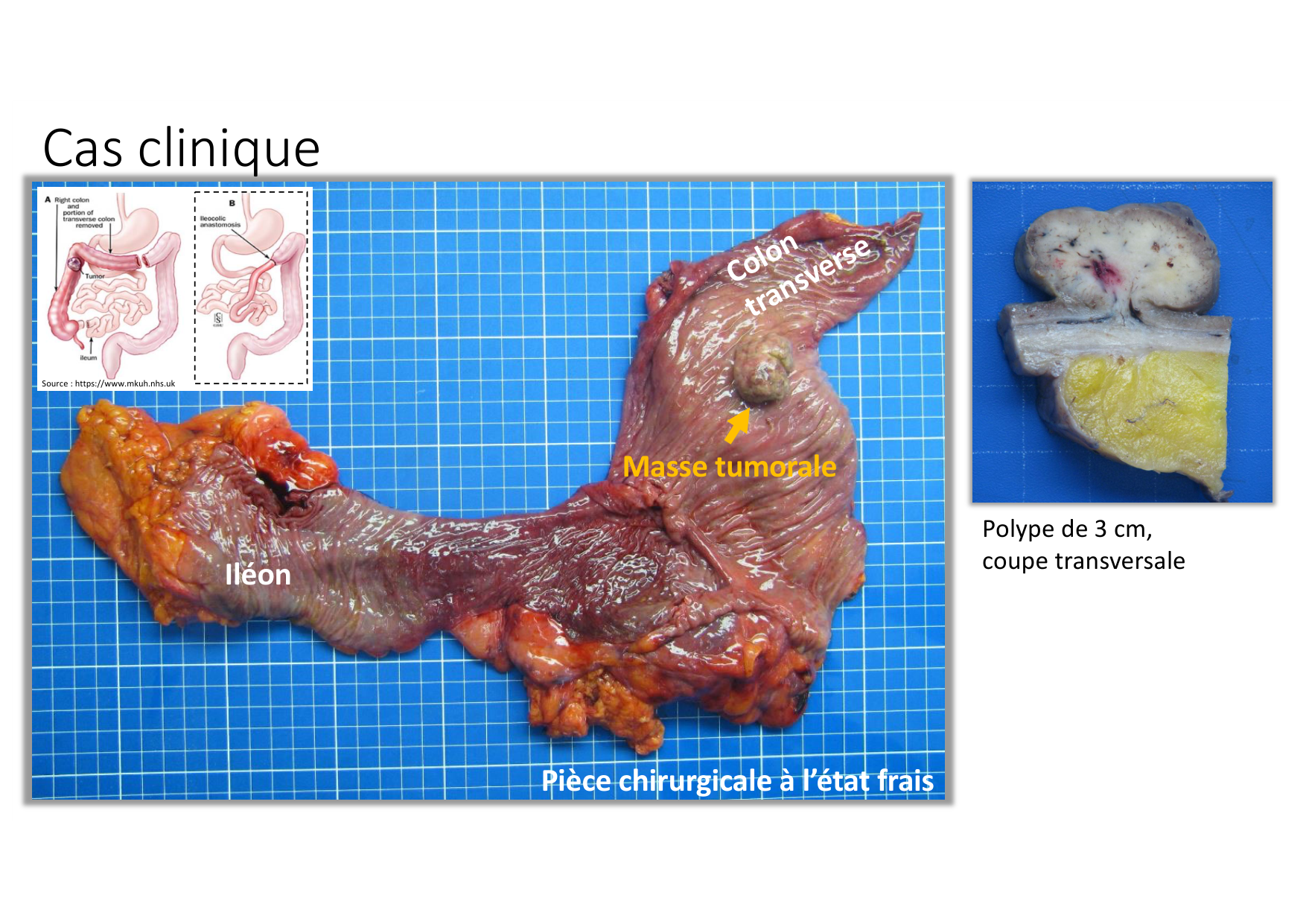 Résolution de linflammation 2026 Egervari page 34
