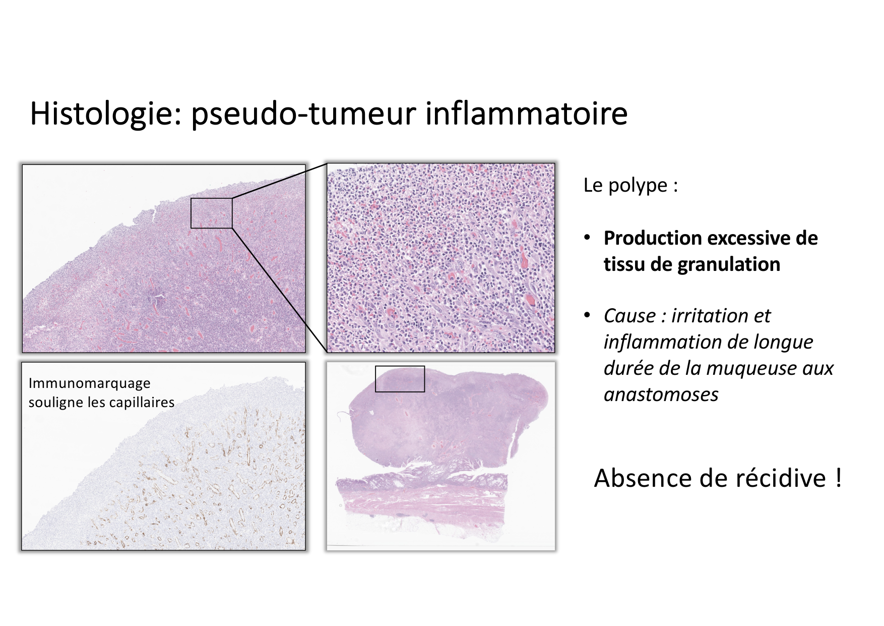 Résolution de linflammation 2026 Egervari page 35