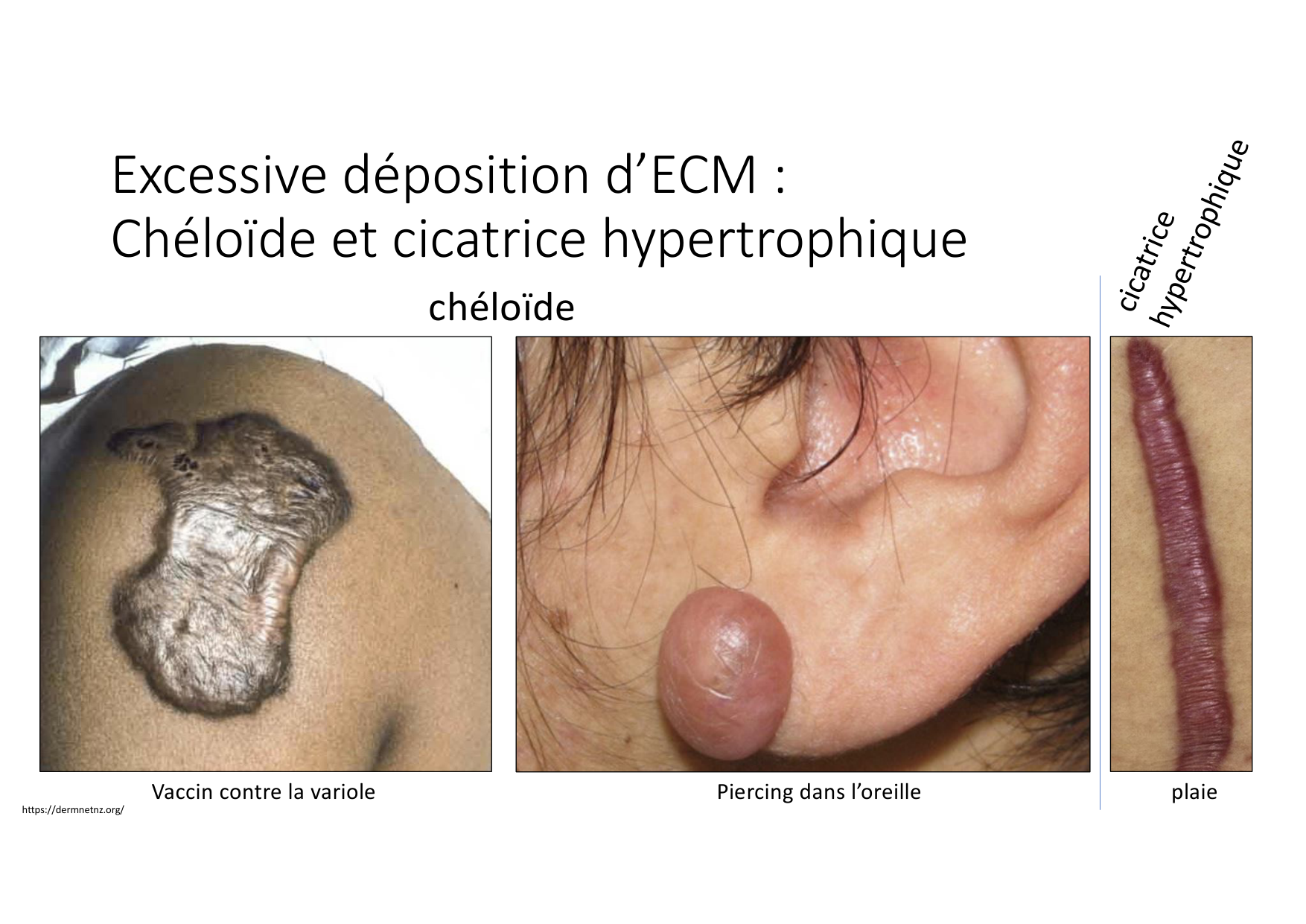 Résolution de linflammation 2026 Egervari page 38