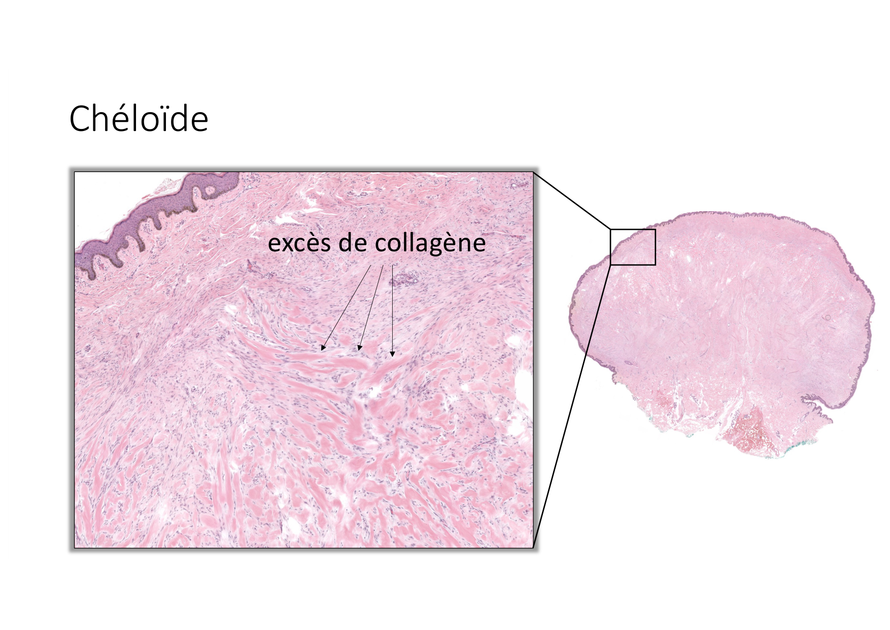 Résolution de linflammation 2026 Egervari page 39