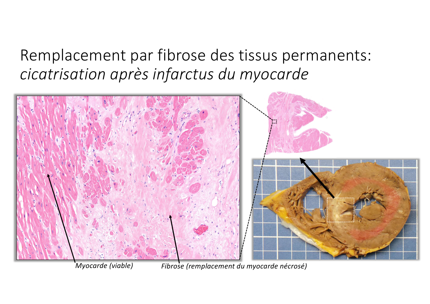 Résolution de linflammation 2026 Egervari page 42