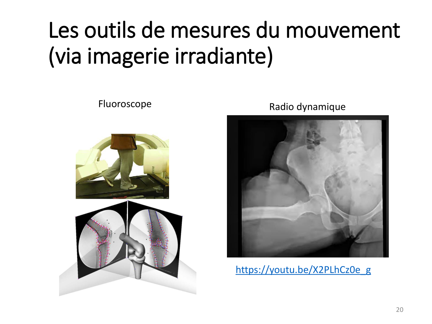 4-BiomecaniqueDuMembreInferieur-2026 page 20
