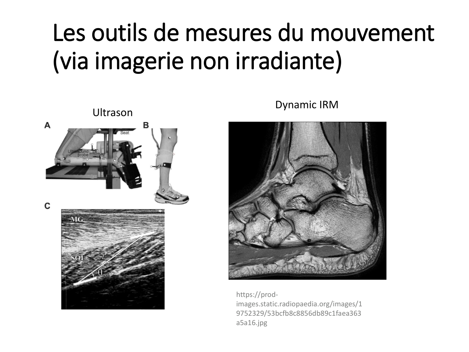 4-BiomecaniqueDuMembreInferieur-2026 page 21