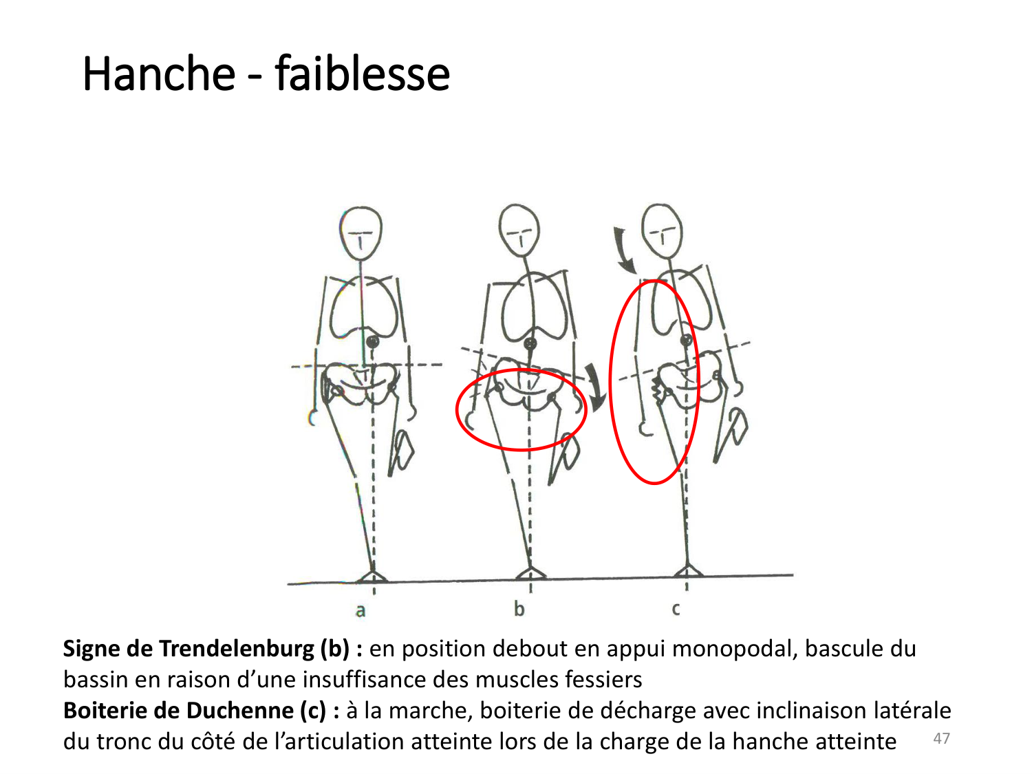 4-BiomecaniqueDuMembreInferieur-2026 page 46
