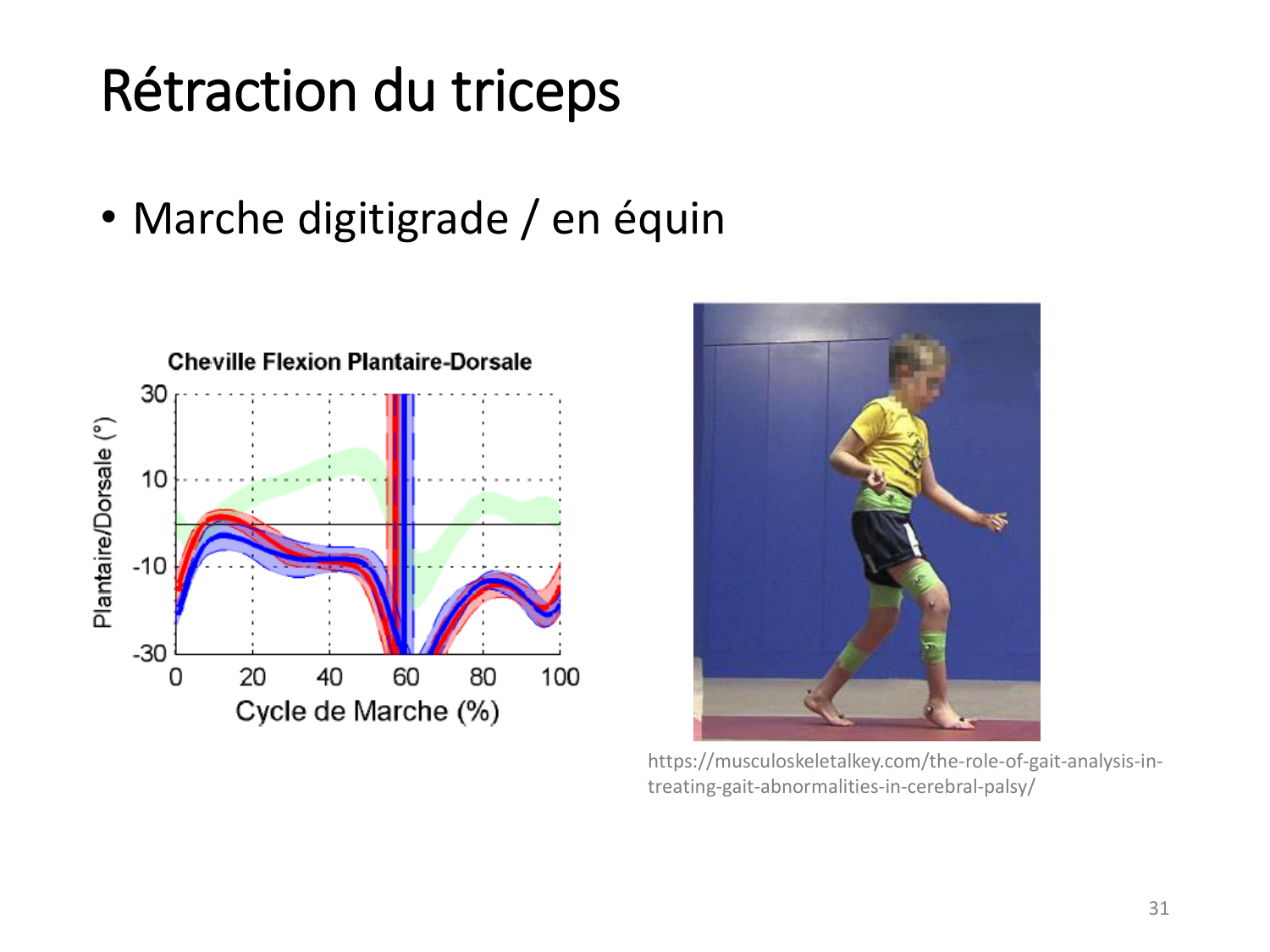 5-PhysiologieBiomecaniqueLocomotion-2026 page 31