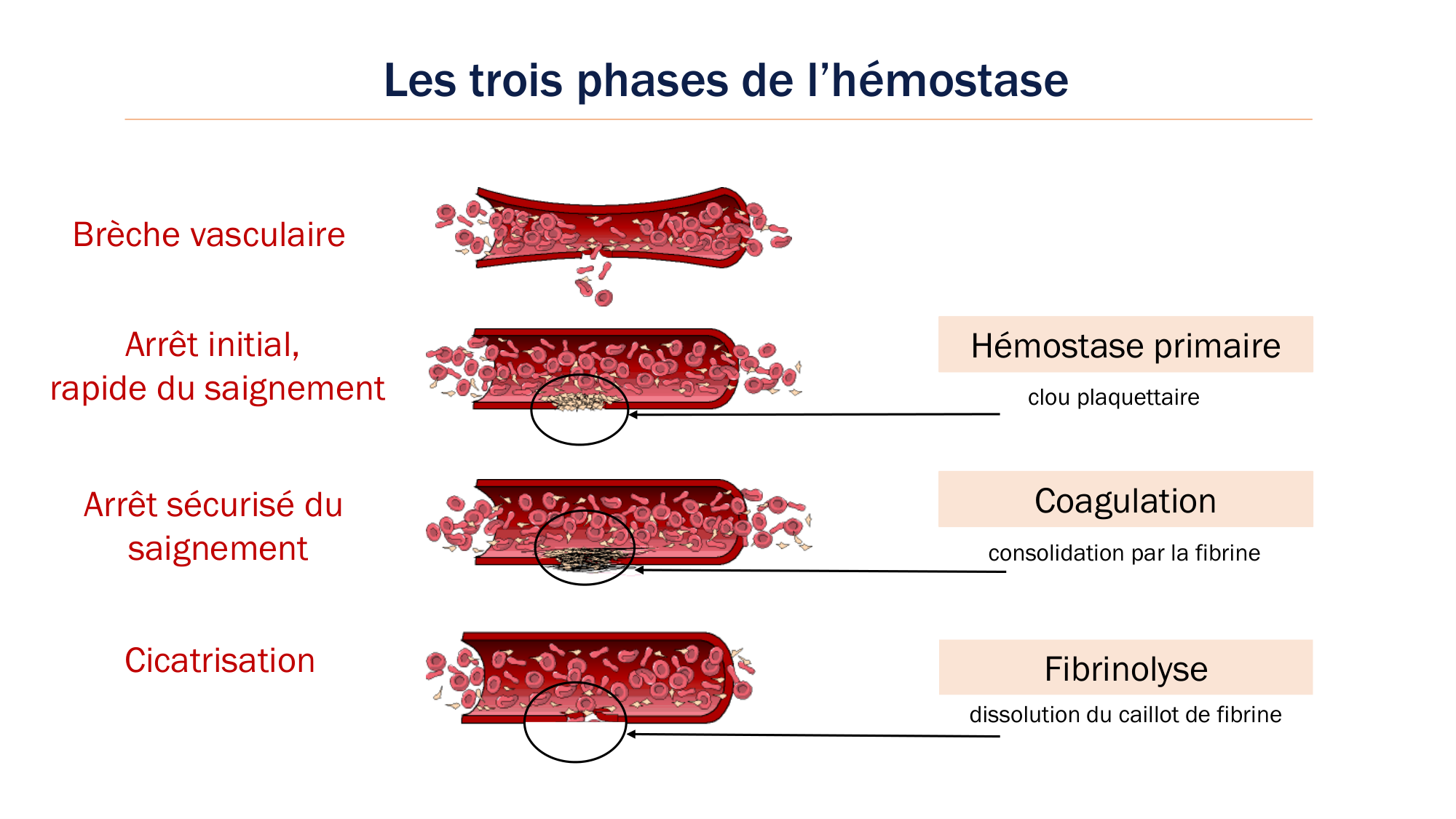 BA1 2026 maladie de lhémostase 3 page 8
