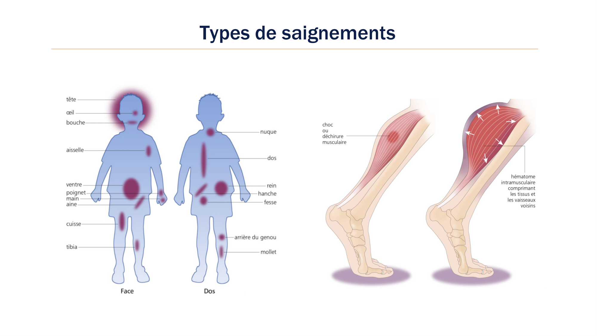 BA1 2026 maladie de lhémostase 3 page 105