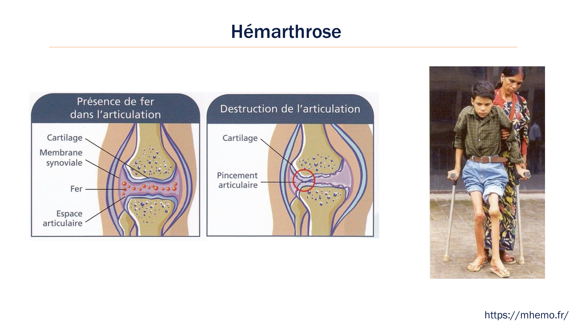 BA1 2026 maladie de lhémostase 3 page 106