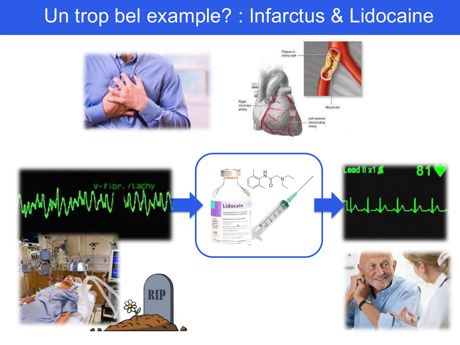 Agoritsas PSS EBM incertitude NBM 2025 page 13