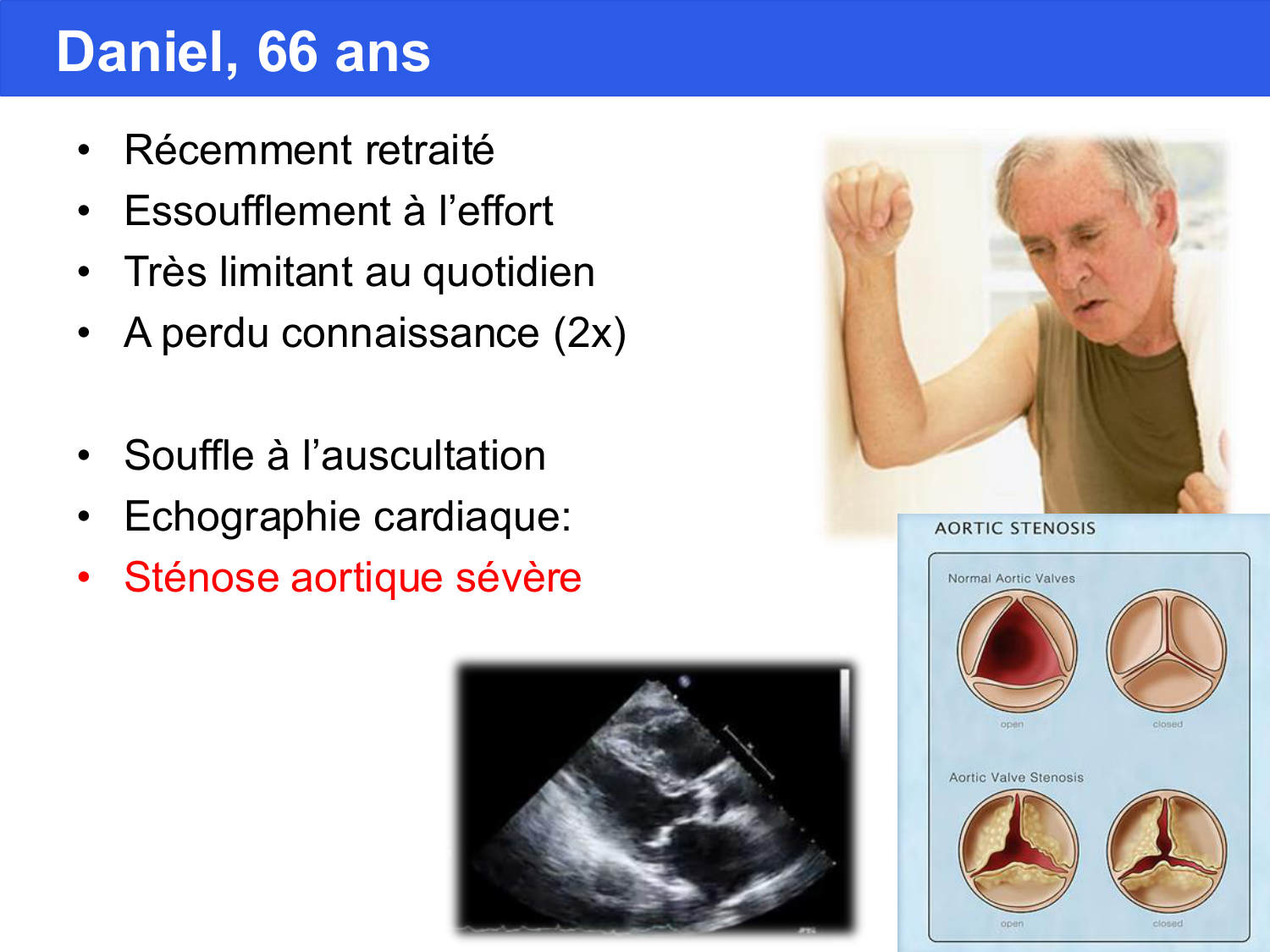 Agoritsas PSS EBM incertitude NBM 2025 page 73