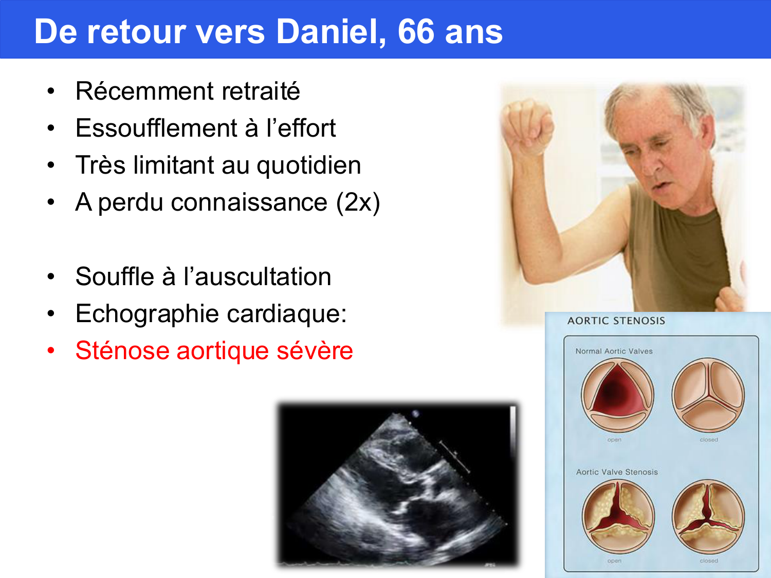 Agoritsas PSS EBM incertitude NBM 2025 page 106