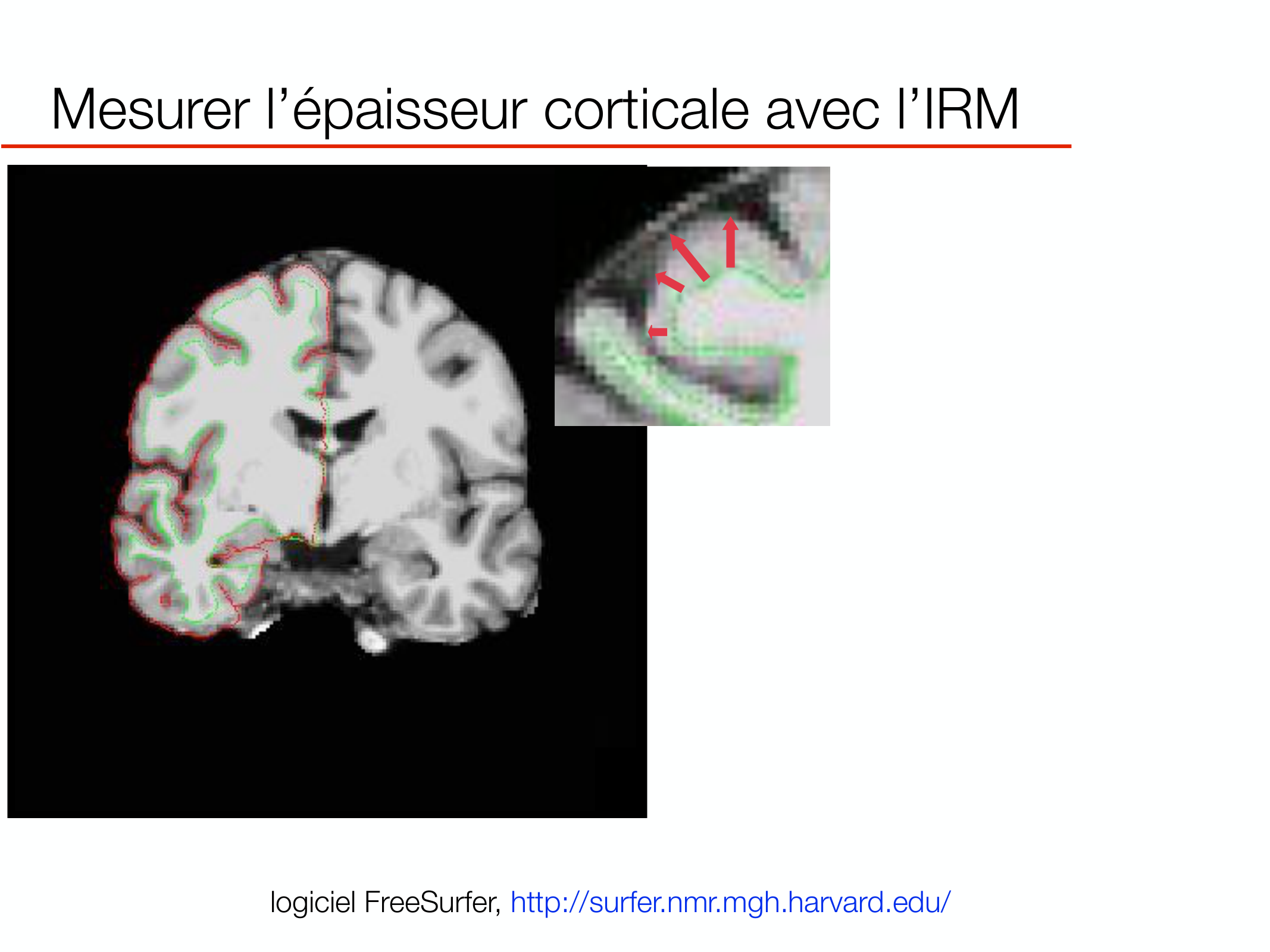 PSS DeveloppementCerebral 2026 page 9