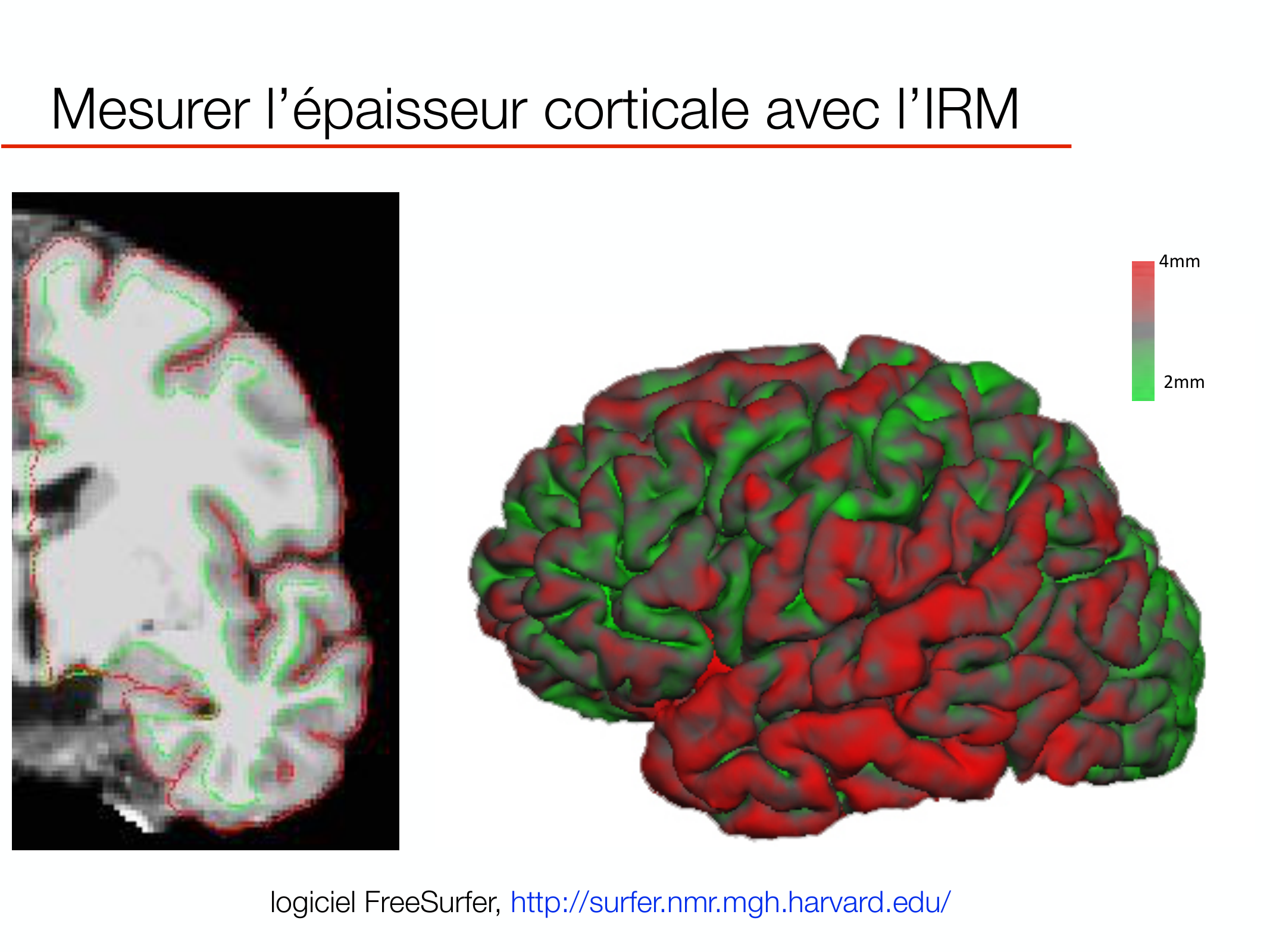 PSS DeveloppementCerebral 2026 page 10