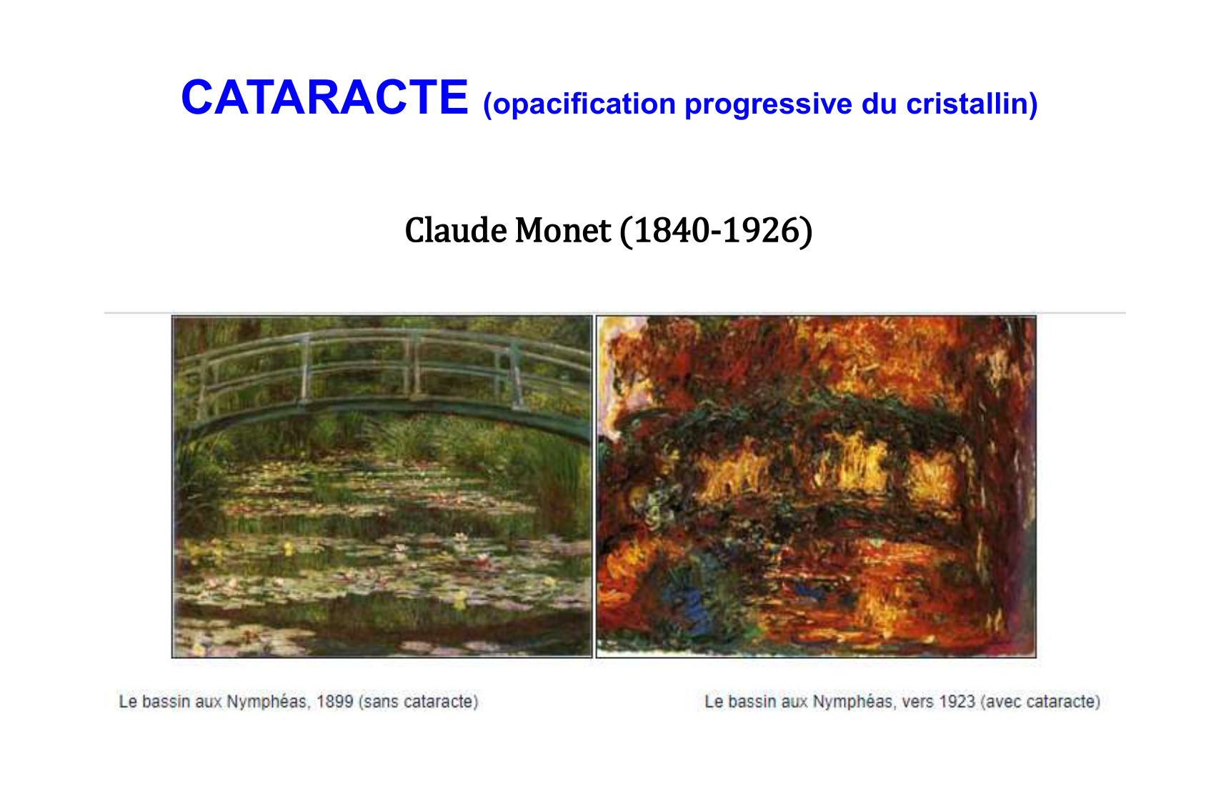 Zekry Vieillissement Vulnerabilite Qualité de vie 02.02.2026BONPSS page 26