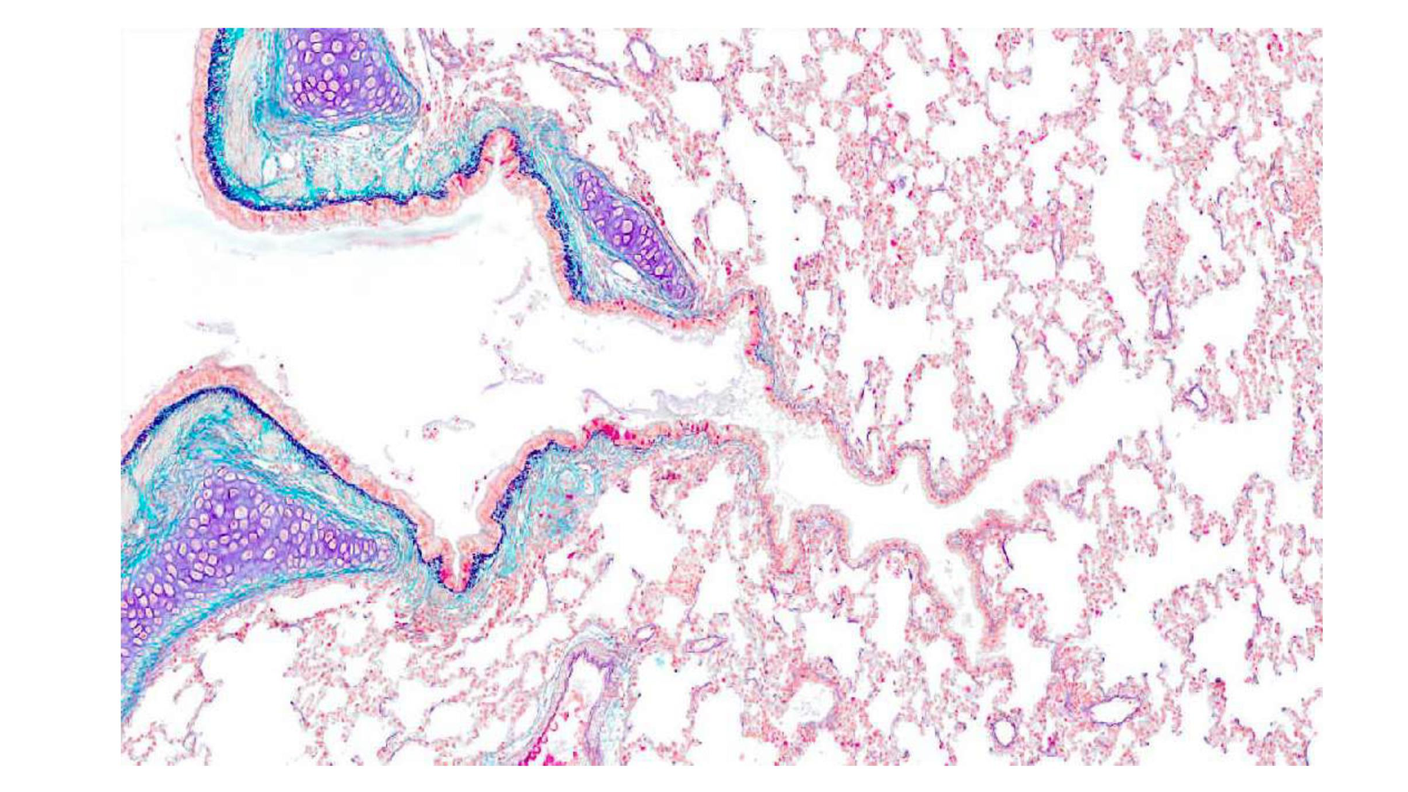 cas de laison MFE 1 page 29
