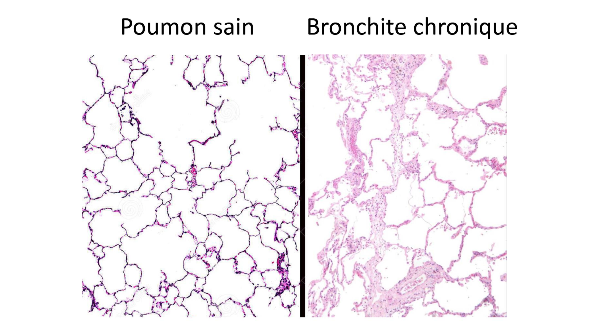 cas de laison MFE 1 page 33
