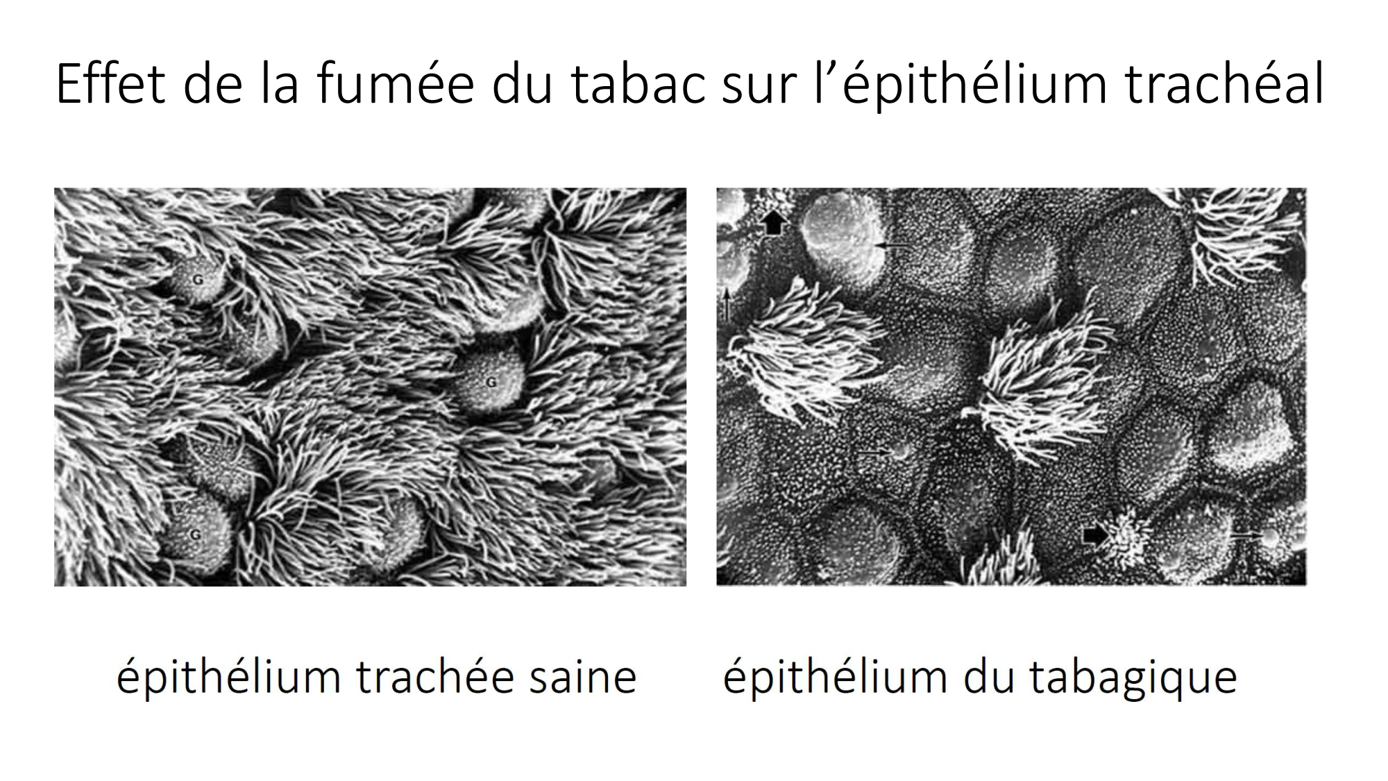 cas de laison MFE 1 page 34