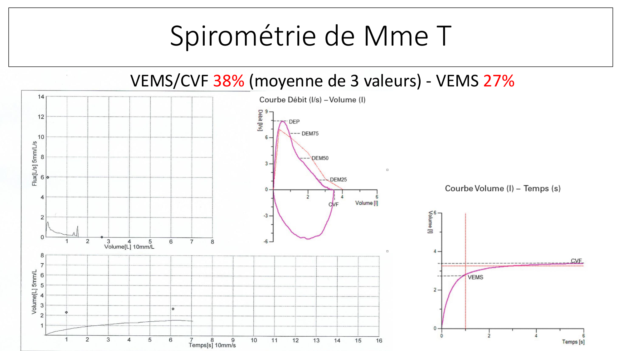 cas de laison MFE 2 page 29