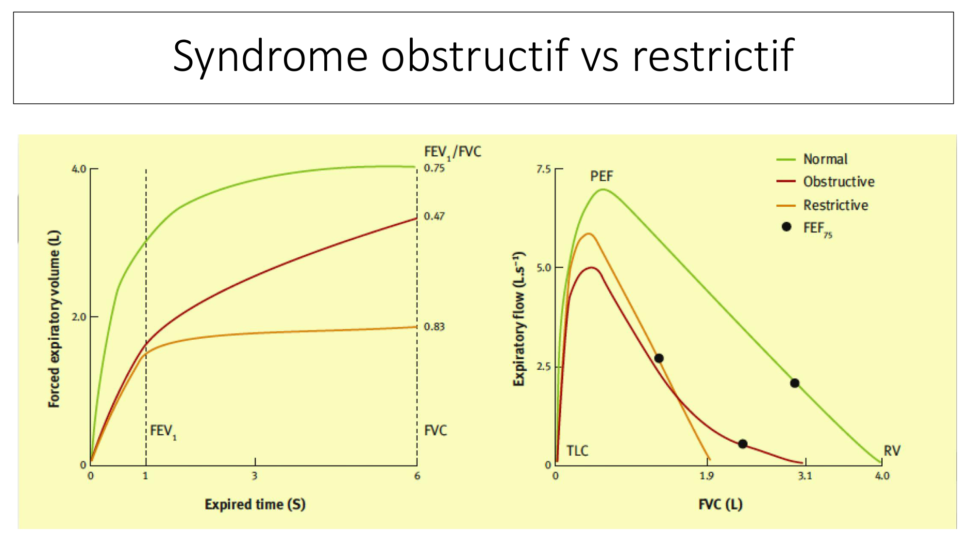 cas de laison MFE 2 page 30