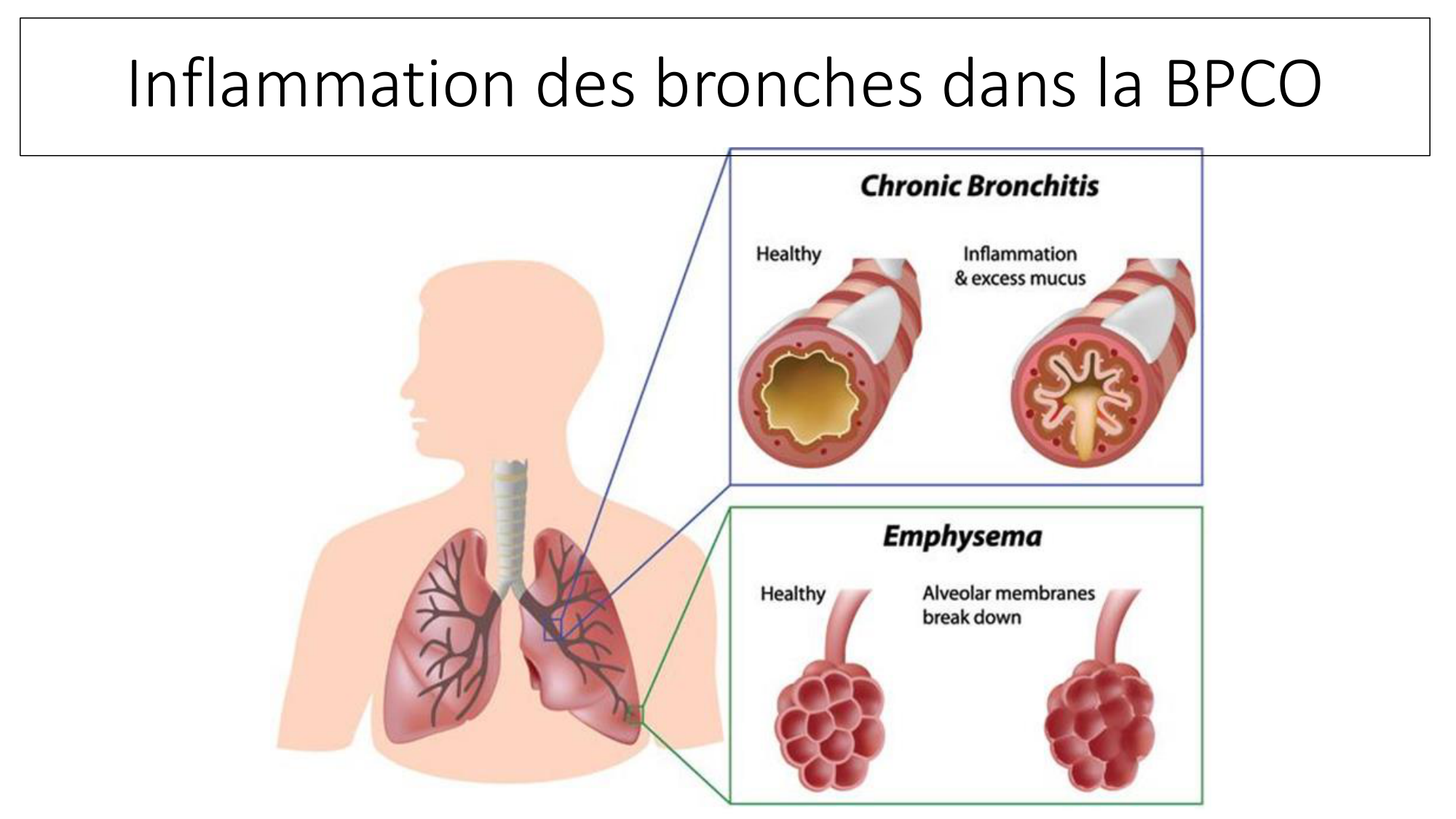 cas de laison MFE 3 page 24