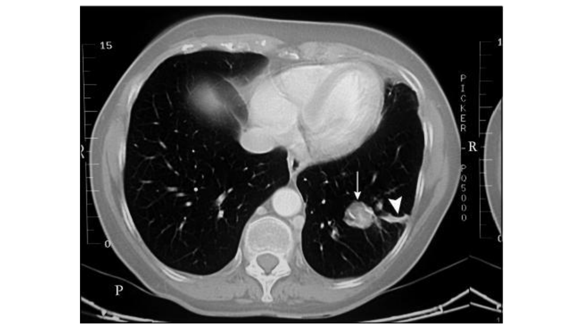 cas de laison MFE 6 page 14