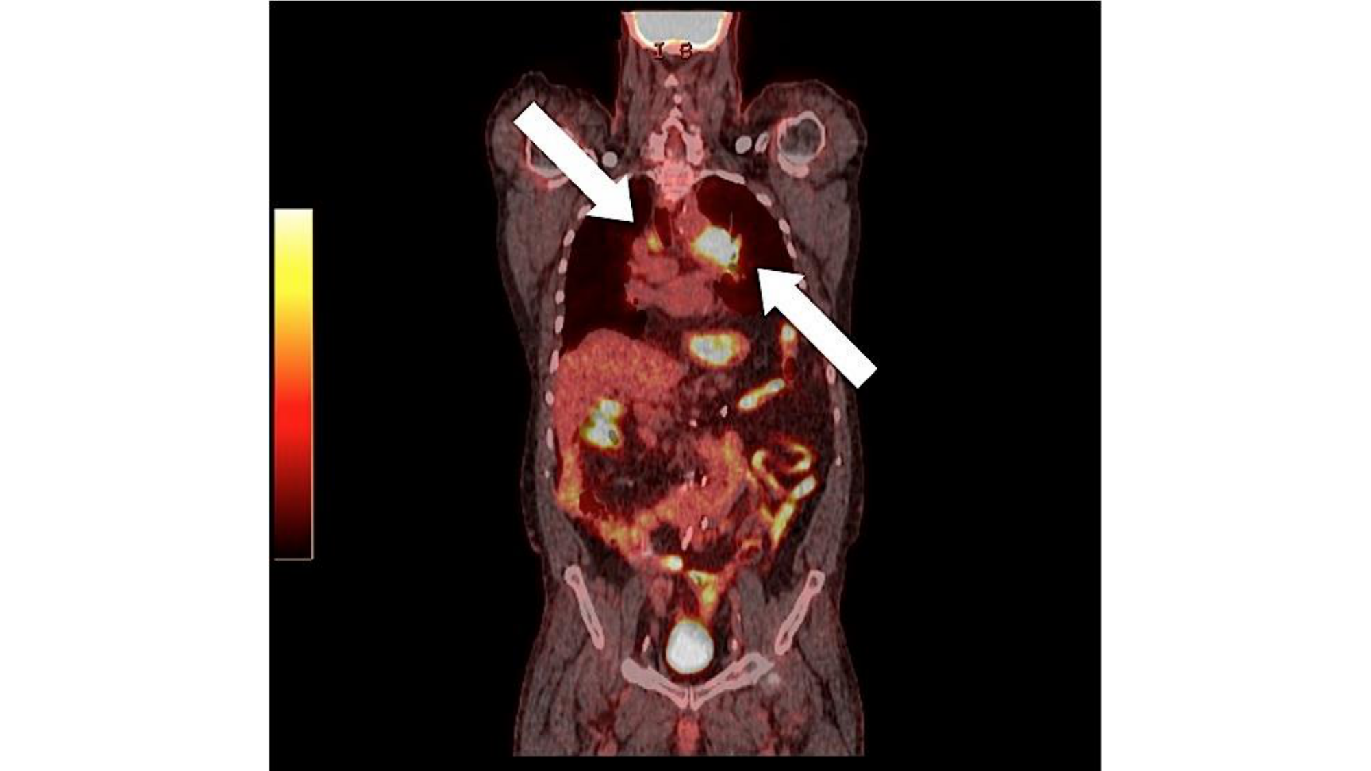 cas de laison MFE 6 page 15