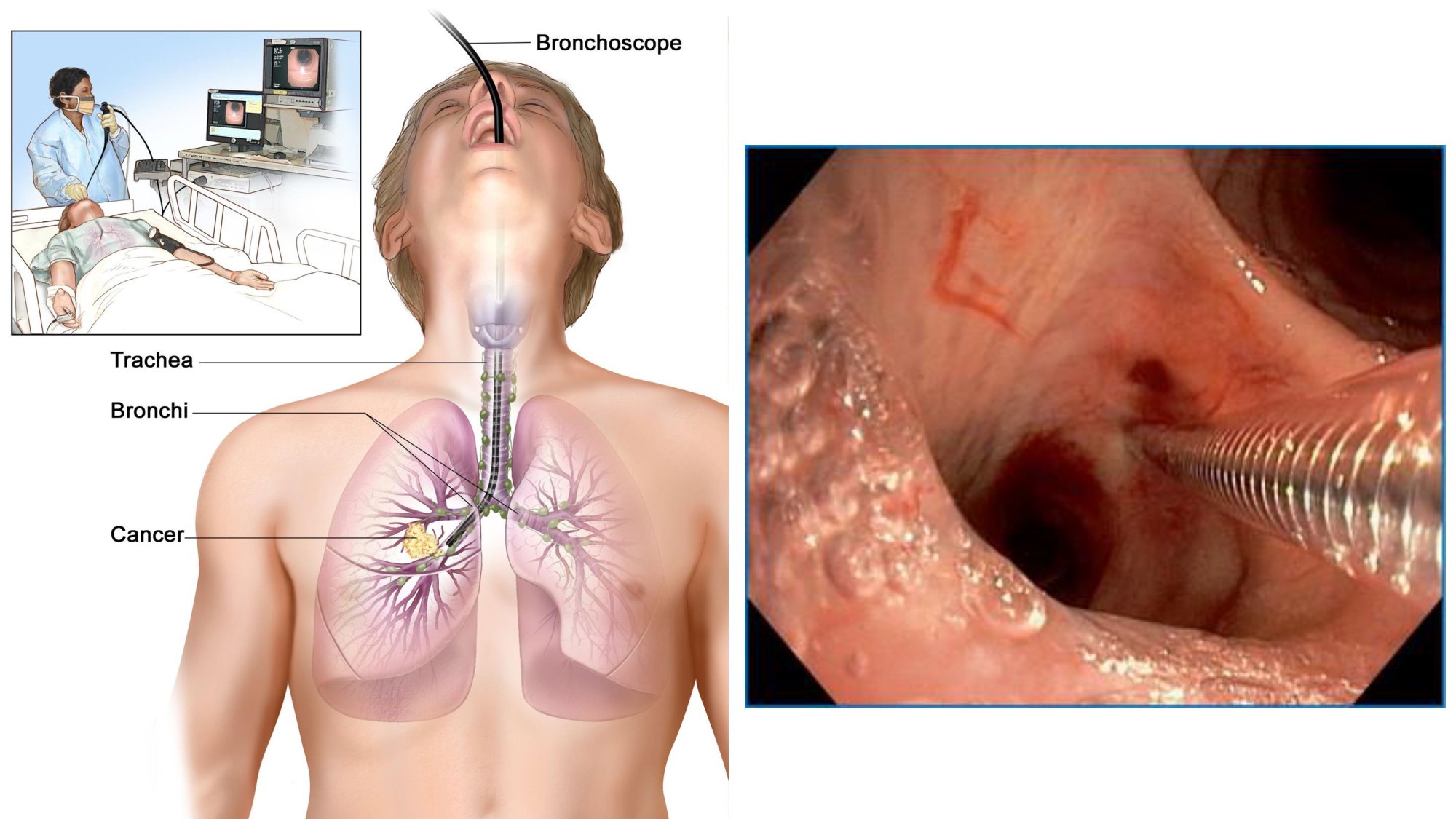 cas de laison MFE 6 page 16