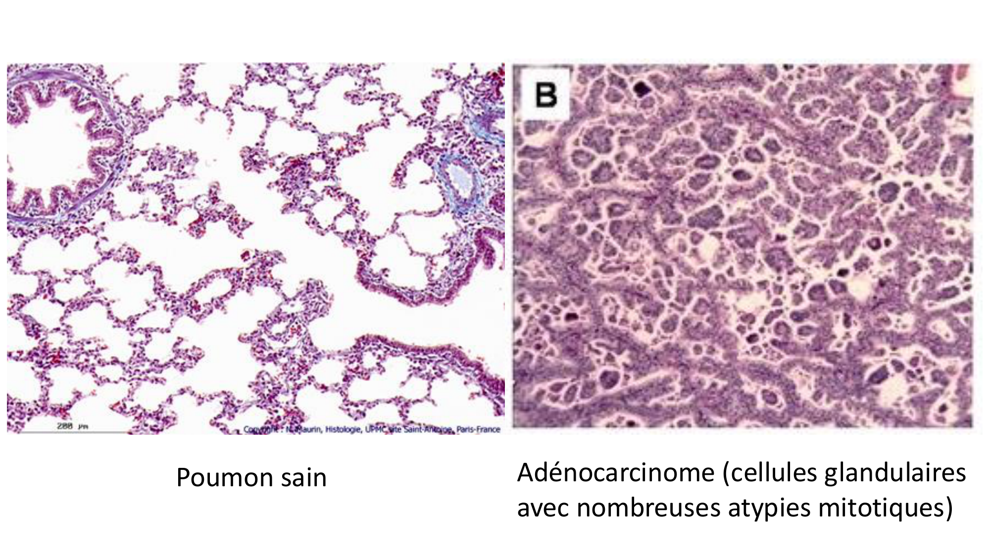 cas de laison MFE 6 page 17