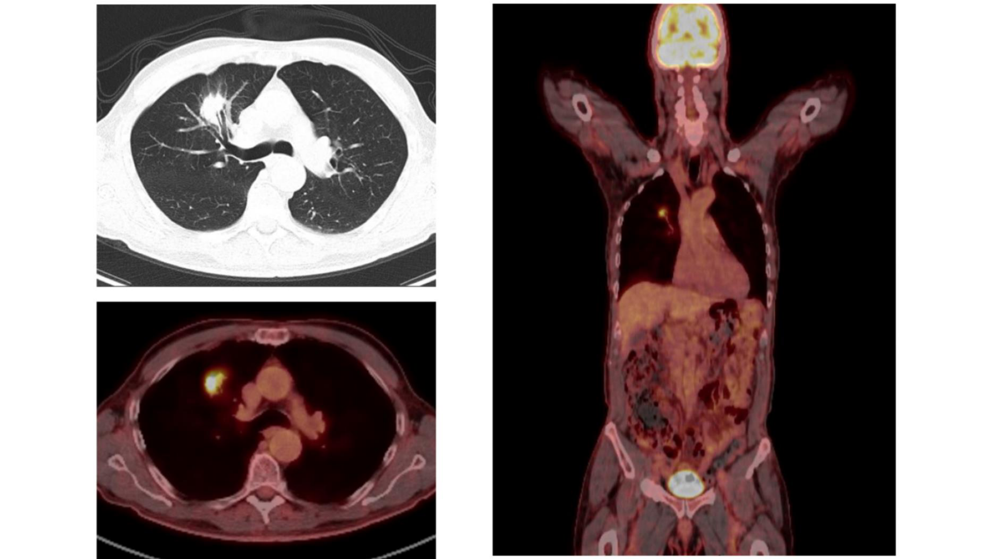 cas de laison MFE 8 page 9