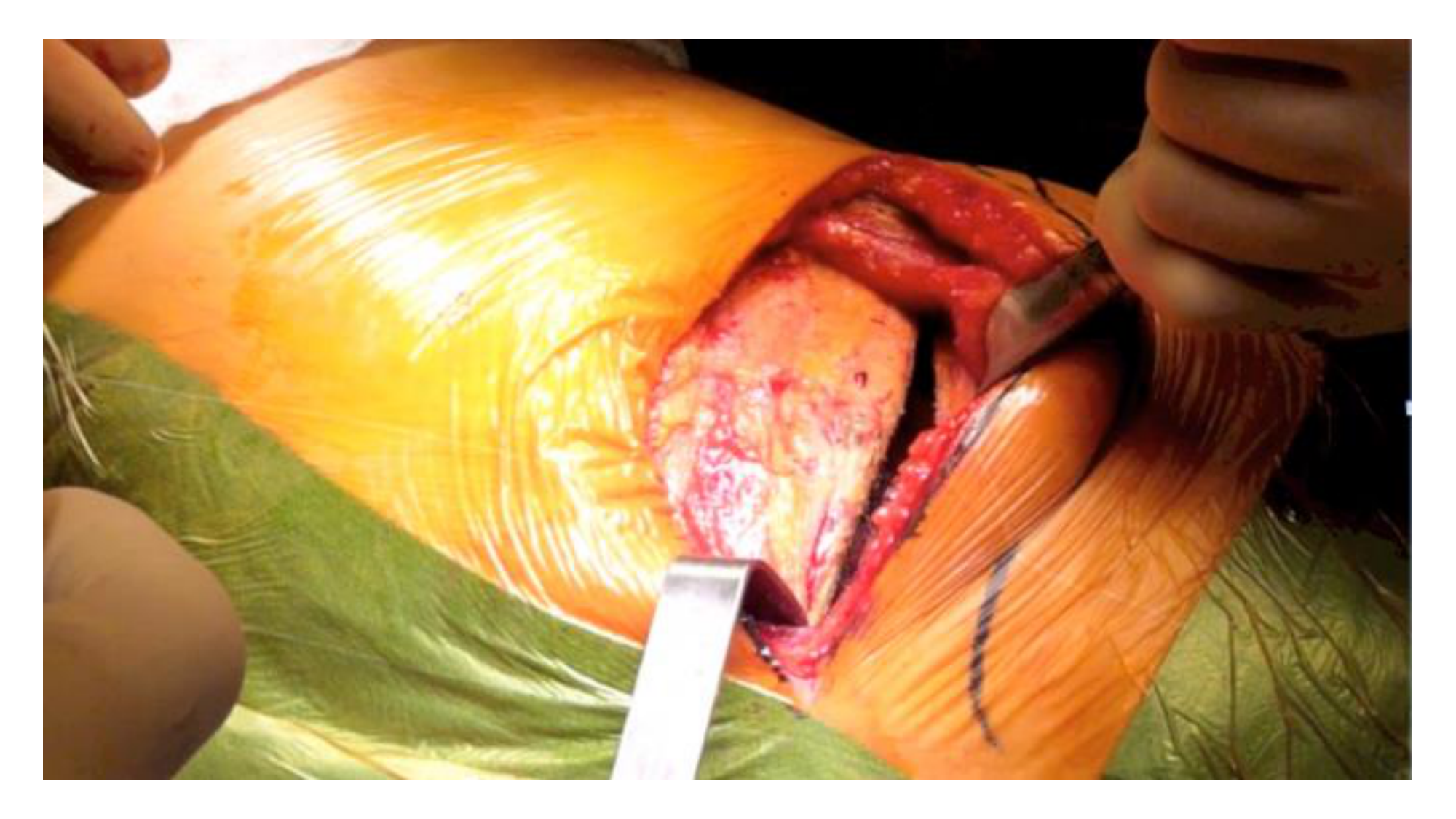 cas de laison MFE 8 page 11