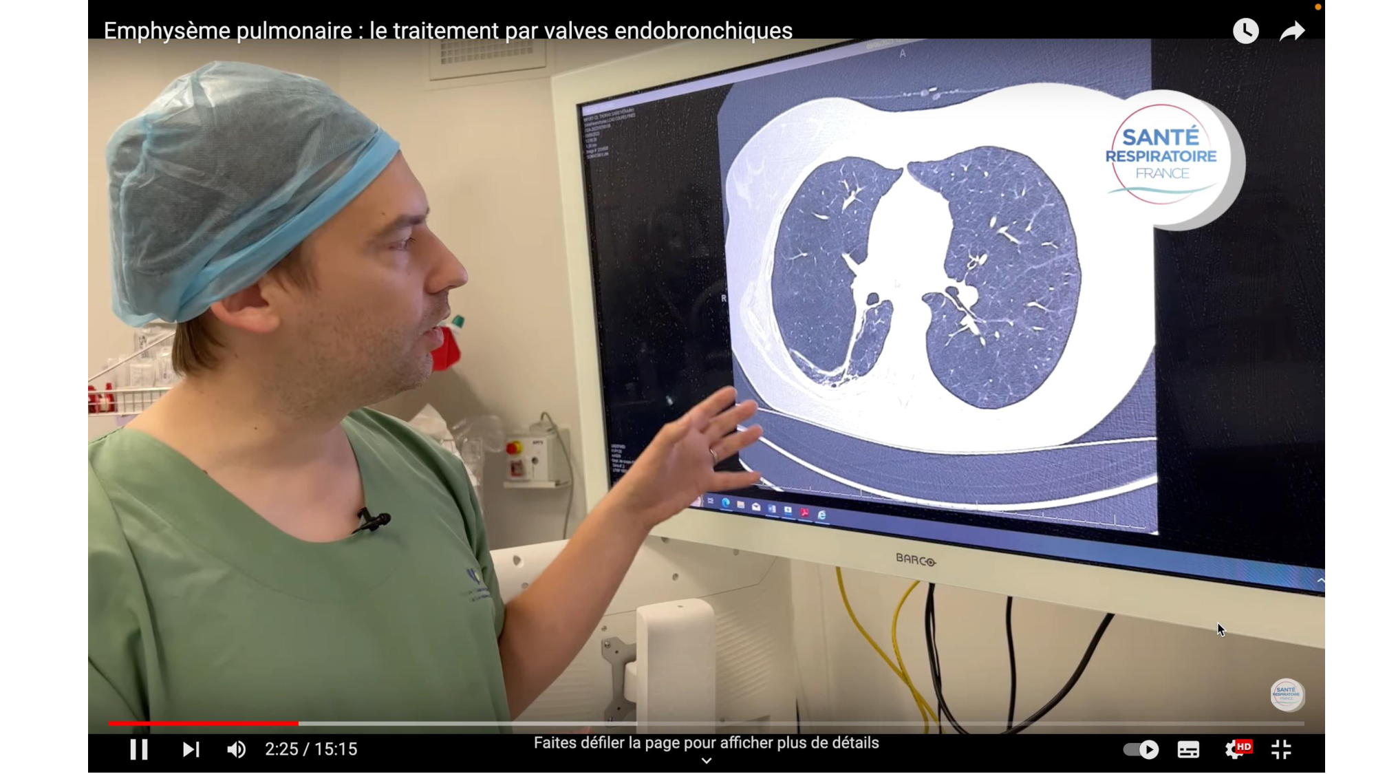 cas de laison MFE 8 page 20